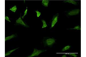 Immunofluorescence of monoclonal antibody to MAPK3 on HeLa cell. (ERK1 anticorps  (AA 279-379))