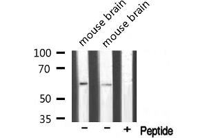Western blot analysis of extracts of various samples,using T3JAM Antibody.