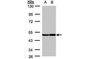 WB Image Sample(30 μg of whole cell lysate) A:A431, B:H1299 10% SDS PAGE antibody diluted at 1:2000
