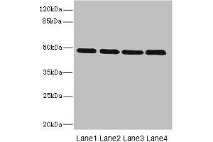 Western blot All lanes: INHBB antibody at 2 μg/mL Lane 1: U87 whole cell lysate Lane 2: A549 whole cell lysate Lane 3: A431 whole cell lysate Lane 4: Hela whole cell lysate Secondary Goat polyclonal to rabbit IgG at 1/10000 dilution Predicted band size: 46 kDa Observed band size: 46 kDa (INHBB anticorps  (AA 295-405))