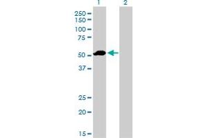 Western Blot analysis of F9 expression in transfected 293T cell line by F9 monoclonal antibody (M01), clone 2C9. (Coagulation Factor IX anticorps  (AA 96-190))