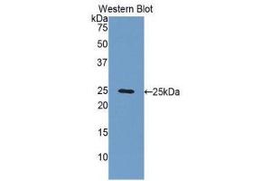 Western Blotting (WB) image for anti-Fibulin 2 (FBLN2) (AA 858-1069) antibody (ABIN1176012) (FBLN2 anticorps  (AA 858-1069))