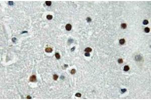 Immunohistochemistry (IHC) analyzes of ASCL1 antibody in paraffin-embedded human brain tissue. (ASCL1 anticorps)