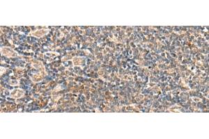 Immunohistochemistry of paraffin-embedded Human tonsil tissue using SEC22B Polyclonal Antibody at dilution of 1:60(x200) (SEC22B anticorps)
