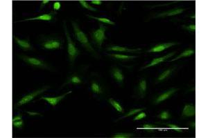 Immunofluorescence of monoclonal antibody to CALCOCO2 on HeLa cell. (CALCOCO2 anticorps  (AA 347-446))