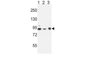 Western Blotting (WB) image for anti-DnaJ (Hsp40) Homolog, Subfamily C, Member 6 (DNAJC6) antibody (ABIN3004410) (DNAJC6 anticorps)