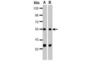 WB Image Sample(30 μg of whole cell lysate) A:HeLa S3 , B:MOLT4 , 15% SDS PAGE antibody diluted at 1:1000 (GPS1 anticorps  (C-Term))