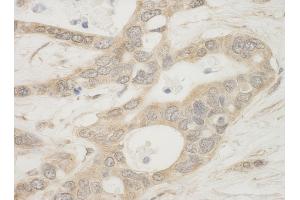 Immunohistochemistry (IHC) image for anti-BCL2-Associated Agonist of Cell Death (BAD) (AA 1-50) antibody (ABIN7448932) (BAD anticorps  (AA 1-50))
