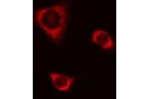 ABIN6277699 staining A549 cells by IF/ICC. (CSTA anticorps  (C-Term))