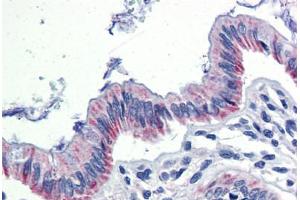 Human Colon (formalin-fixed, paraffin-embedded) stained with EGR2 antibody ABIN462263 followed by biotinylated goat anti-rabbit IgG secondary antibody ABIN481713, alkaline phosphatase-streptavidin and chromogen.