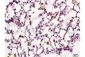 Formalin-fixed and paraffin embedded rat brain tissue labeled with Anti-Synaptotagmin 1/SYT1 Polyclonal Antibody, Unconjugated (ABIN754888) at 1:200 followed by conjugation to the secondary antibody, (SP-0023), and DAB staining