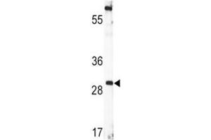 Western blot analysis of BDNF antibody and CEM lysate. (BDNF anticorps  (AA 206-236))