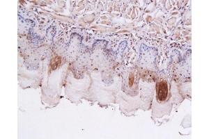 Formalin-fixed and paraffin embedded rat tongue labeled with Anti-GLP-1 (7-36) Polyclonal Antibody, Unconjugated 1:200 followed by conjugation to the secondary antibody and DAB staining
