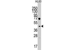 Western blot analysis of LEFTY1 polyclonal antibody  in HL-60 cell line lysates (35 ug/lane). (LEFTY1 anticorps  (AA 291-320))