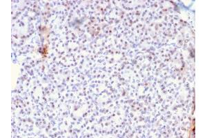 Formalin-fixed, paraffin-embedded human Pancreas stained with AKT1 Mouse Monoclonal Antibody (AKT1/2784).