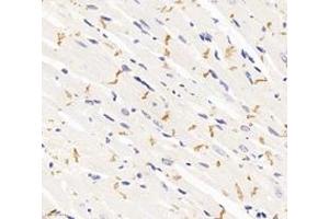 Immunohistochemistry analysis of paraffin-embedded rat heart using,DSP (ABIN7073719) at dilution of 1: 1000