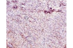 Immunohistochemistry of paraffin-embedded human tonsil tissue using ABIN7177073 at dilution of 1:10 (CES1C anticorps  (AA 19-550))