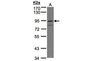 PTGFRN anticorps  (C-Term)
