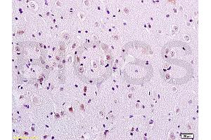 Formalin-fixed and paraffin embedded rat brain tissue labeled with Anti-FOXC1/FREAC3 Polyclonal Antibody, Unconjugated (ABIN719291) at 1:200 followed by conjugation to the secondary antibody and DAB staining (FOXC1 anticorps  (AA 101-200))