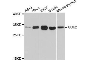 Western blot analysis of extracts of various cell lines, using UCK2 antibody (ABIN5999140) at 1/1000 dilution. (UCK2 anticorps)