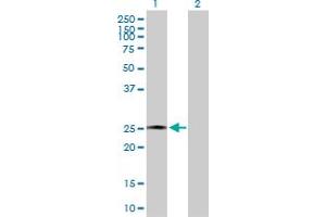 Western Blot analysis of AMELX expression in transfected 293T cell line by AMELX MaxPab polyclonal antibody. (AMELX anticorps  (AA 1-191))