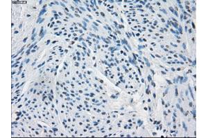 Immunohistochemical staining of paraffin-embedded endometrium tissue using anti-FHmouse monoclonal antibody. (FH anticorps)