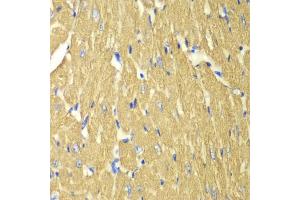 Immunohistochemistry of paraffin-embedded mouse heart using TPM3 antibody (ABIN6291029) at dilution of 1:100 (40x lens). (TPM3 anticorps)