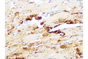 Immunohistochemistry of paraffin-embedded mouse heart using Myosin heavy chain Rabbit mAb (ABIN7268750) at dilution of 1:100 (40x lens). (MYH7 anticorps)