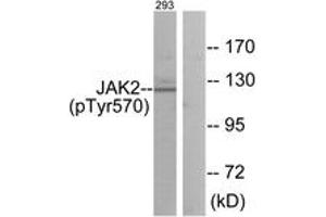 Western blot analysis of extracts from 293 cells treated with etoposide 25uM 24h, using JAK2 (Phospho-Tyr570) Antibody. (JAK2 anticorps  (pTyr570))
