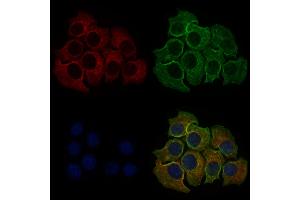 ABIN6257434 and ABIN6273695 staining Hela cells by IF/ICC.