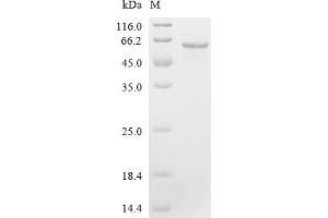 Janus Kinase 2 (JAK2) (AA 30-482) protein (His tag)