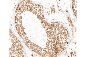 ABIN6266593 at 1/100 staining human testis tissue sections by IHC-P.