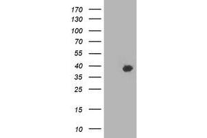 Western Blotting (WB) image for anti-HSPA Binding Protein, Cytoplasmic Cochaperone 1 (HSPBP1) antibody (ABIN1498758) (HSPBP1 anticorps)