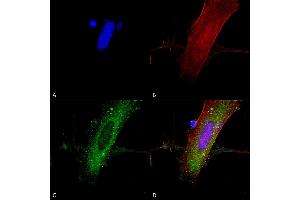 Immunocytochemistry/Immunofluorescence analysis using Mouse Anti-GluN2A/NR2A Monoclonal Antibody, Clone S327A-38 (ABIN2483901).