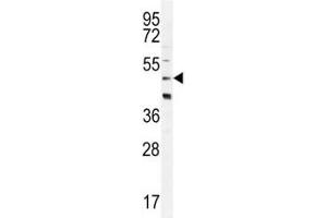 CRFR2D antibody western blot analysis in HeLa lysate (CRFR2D anticorps)