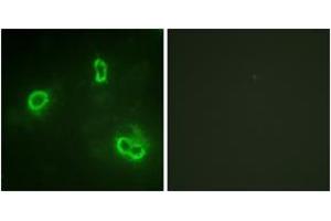 Immunofluorescence analysis of COS7 cells, using p90 RSK (Ab-573) Antibody. (RPS6KA3 anticorps  (AA 539-588))