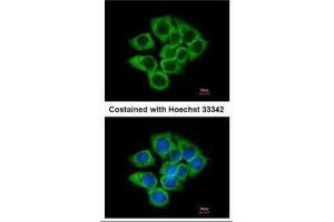 ICC/IF Image Immunofluorescence analysis of methanol-fixed A431, using EEF1D, antibody at 1:200 dilution. (EEF1D anticorps)