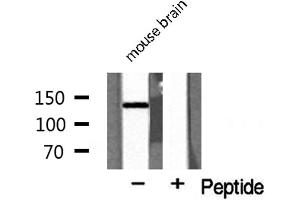 Western blot analysis of MEKKK 4 expression in mouse brain lysate (MAP4K4 anticorps  (Internal Region))