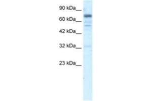 Western Blotting (WB) image for anti-Ras and Rab Interactor 3 (RIN3) antibody (ABIN2461005) (RIN3 anticorps)