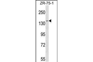 Western blot analysis in ZR-75-1 cell line lysates (35ug/lane). (PAN2 anticorps  (C-Term))