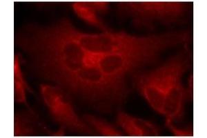 Image no. 1 for anti-Breakpoint Cluster Region (BCR) (Tyr177) antibody (ABIN197420) (BCR anticorps  (Tyr177))