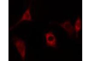 ABIN6278432 staining Hela cells by IF/ICC. (Cathepsin H anticorps  (Internal Region))