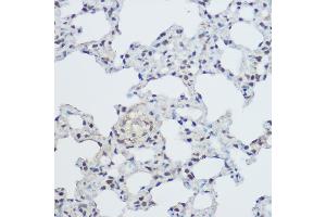 Immunohistochemistry of paraffin-embedded mouse lung using XRCC1 Rabbit pAb (ABIN1683300, ABIN5663662, ABIN5663663, ABIN5663664 and ABIN6213850) at dilution of 1:300 (40x lens).