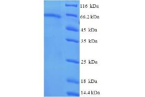 SDS-PAGE (SDS) image for Tubulin, beta 6 (TUBb6) (AA 1-446), (full length) protein (His-SUMO Tag) (ABIN5711879)