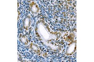 Immunohistochemistry of paraffin embedded mouse uterus using SRRM2 (ABIN7075555) at dilution of 1:650 (400x lens) (SRRM2 anticorps)