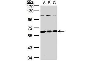 WB Image Sample(30 ug whole cell lysate) A:H1299 B:HeLa S3, C:Hep G2 , 7. (BIVM anticorps  (C-Term))