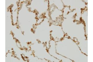 anti-SH2 Domain Containing 4A (SH2D4A) (AA 239-338) antibody