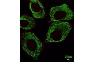 Immunofluorescent analysis of A549 cells using beta-Tubulin antibody at 1:25 dilution.