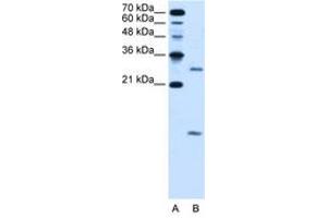 Image no. 2 for anti-Vacuolar H+-ATPase Homolog (VMA21) (N-Term) antibody (ABIN205060) (VMA21 anticorps  (N-Term))