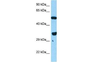 Host:  Mouse  Target Name:  FOXL1  Sample Tissue:  Mouse Skeletal Muscle  Antibody Dilution:  1ug/ml (FOXL1 anticorps  (N-Term))